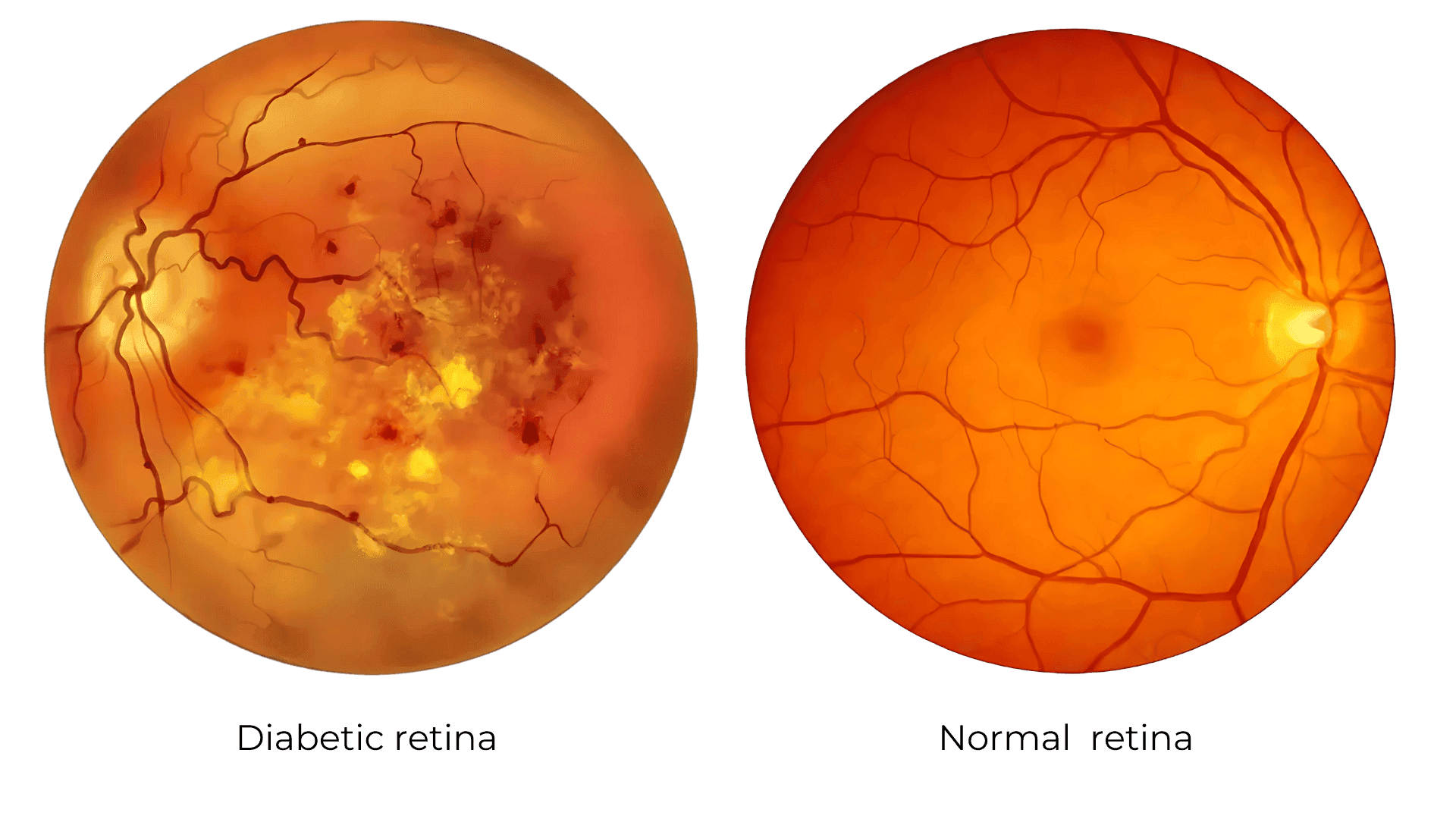 retina
